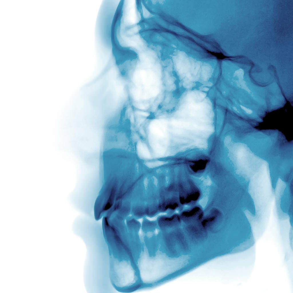 Kombinierte Behandlung